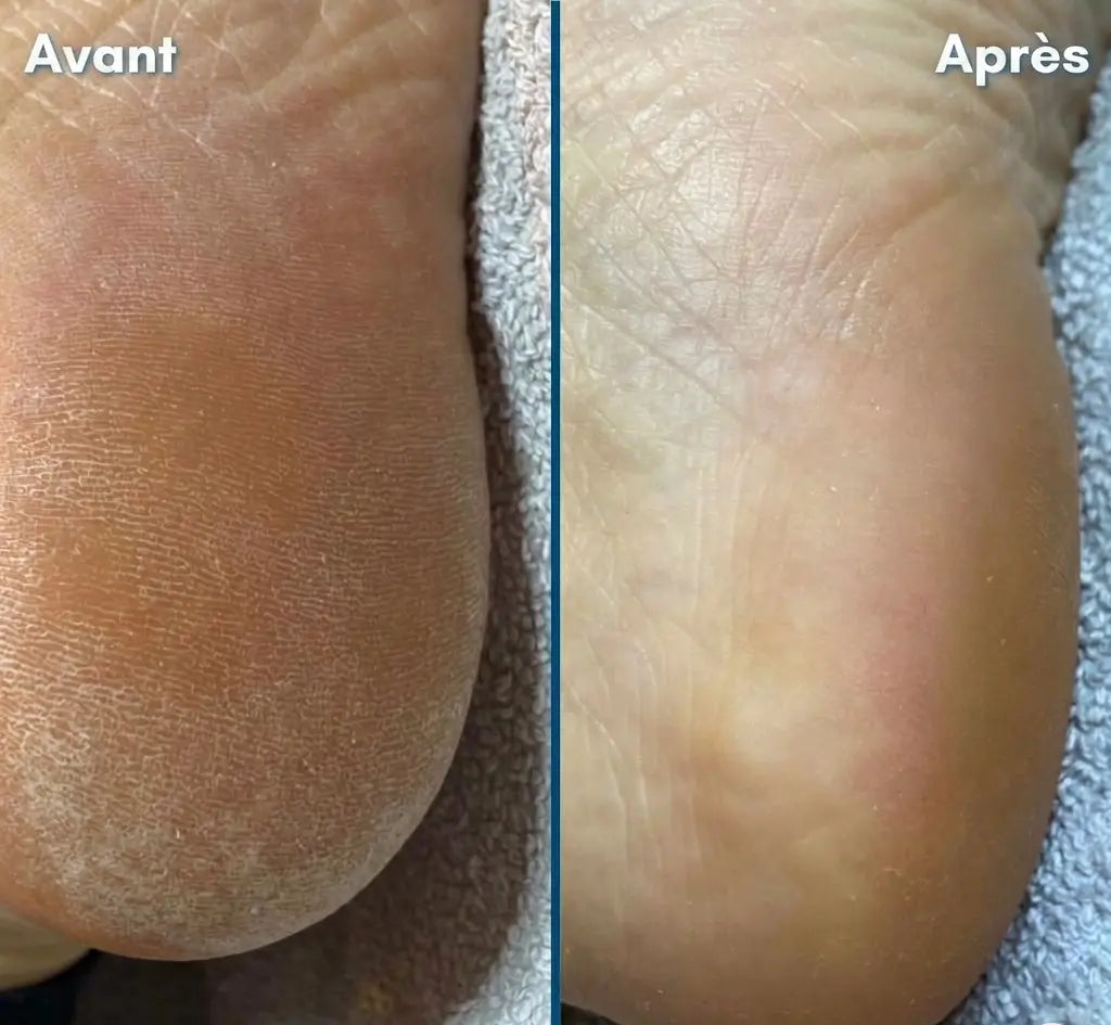 Chufed Coffret de soins pour les mains et les pieds
