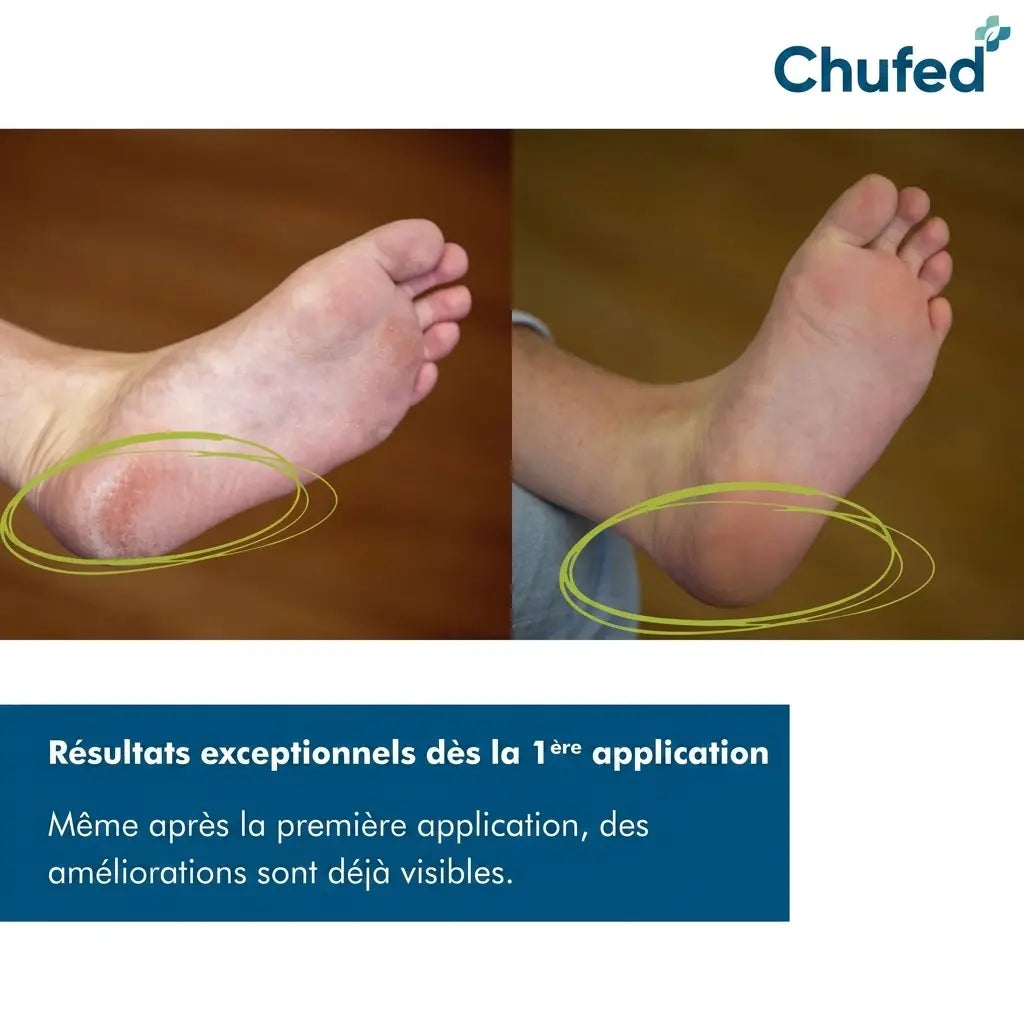 Chufed Coffret de soins pour les mains et les pieds