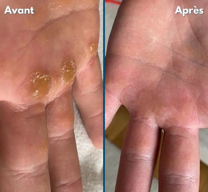 Chufed Coffret de soins pour les mains et les pieds